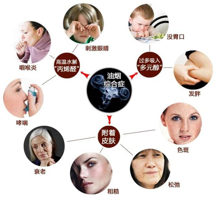 金利集成灶：让你的家人远离厨房油烟带来的困扰